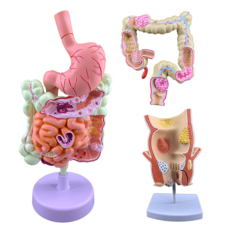Medical Lab Observer - Modelo ensino patologia 3D Q6PA, exibição